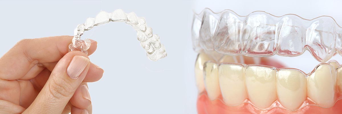 Marietta Alternative to Braces for Teens