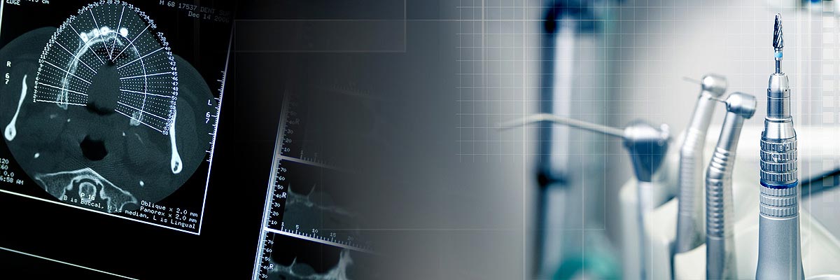 Marietta Will I Need a Bone Graft for Dental Implants?