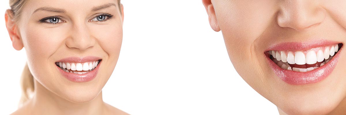 Marietta Cosmetic Dental Services
