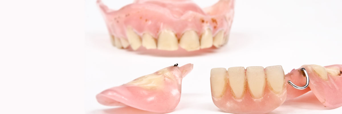 Marietta What Do I Do If I Damage My Dentures?