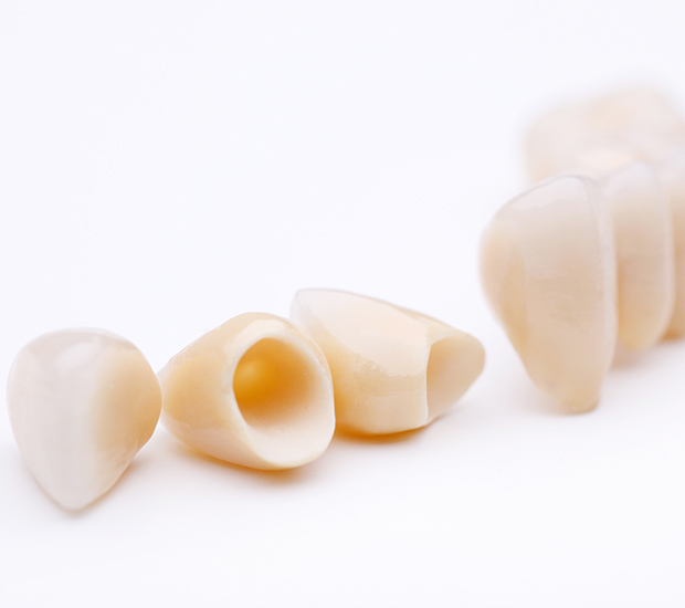 Marietta Dental Crowns and Dental Bridges