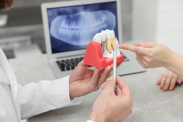 What Is Dental Implant Restoration?