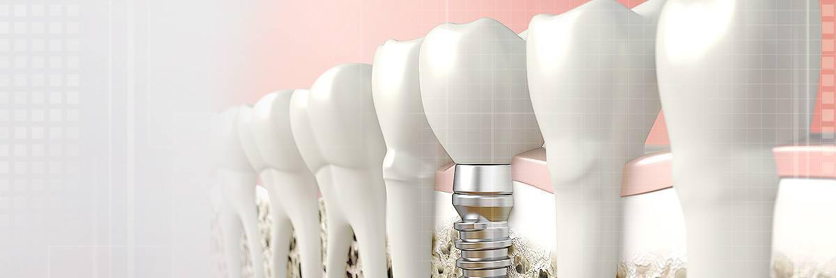 Marietta Dental Prosthetics