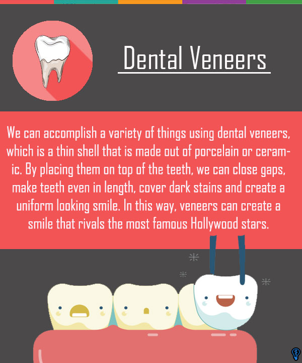 Dental Veneers and Dental Laminates Marietta, GA