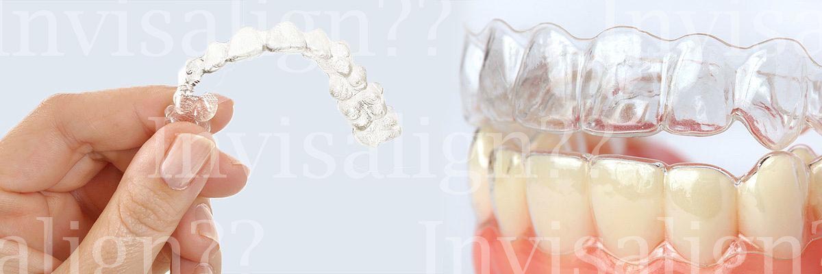 Marietta Does Invisalign® Really Work?
