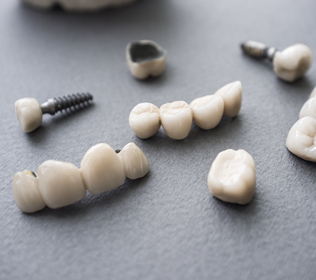 Marietta The Difference Between Dental Implants and Mini Dental Implants