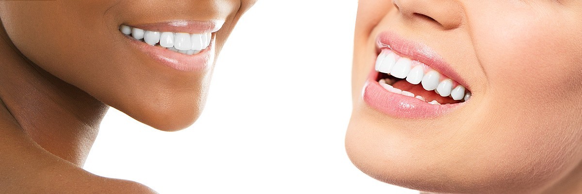 Marietta Improve Your Smile for Senior Pictures