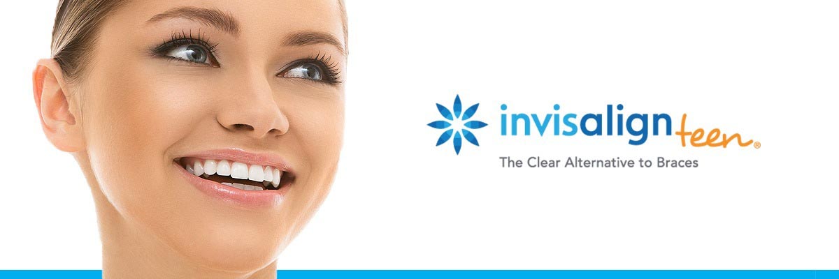 Marietta Invisalign vs Traditional Braces