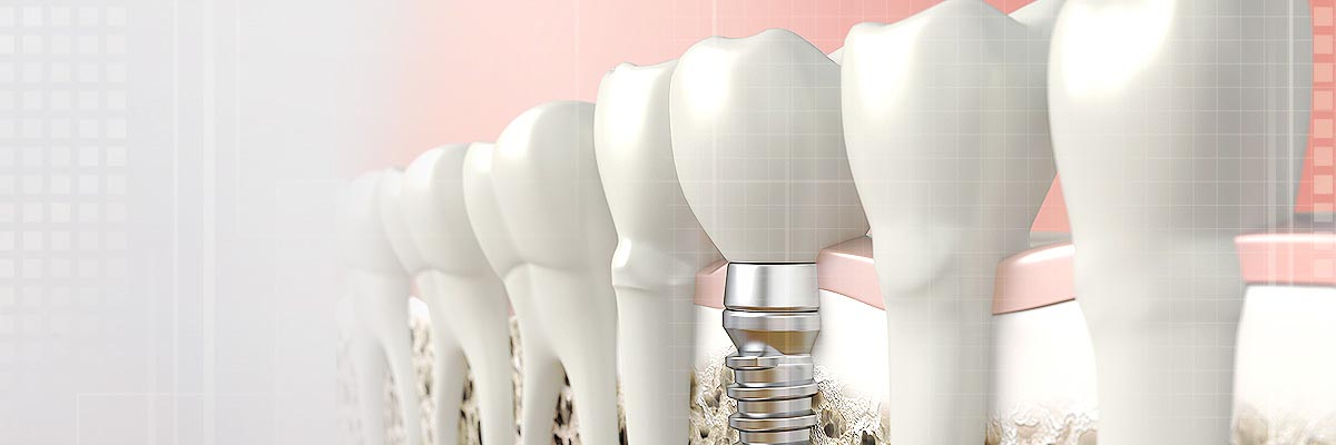 Marietta Oral Prosthetics Doctor
