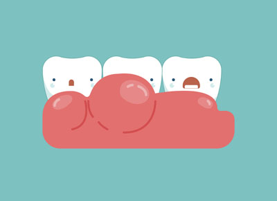 Dental Oral Surgery And Gum Recession