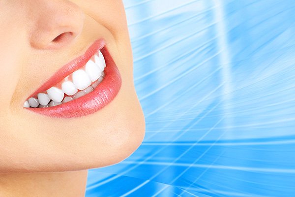 smile makeover Marietta, GA