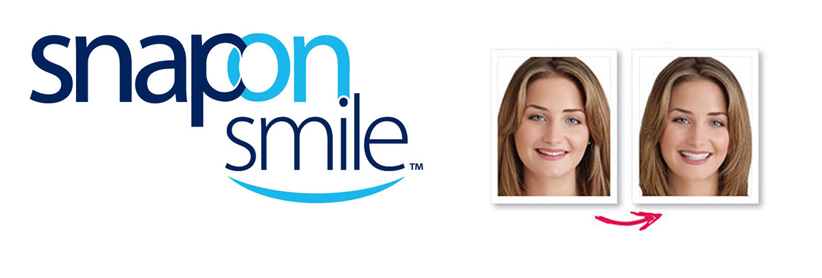 Marietta Snap-On Smile