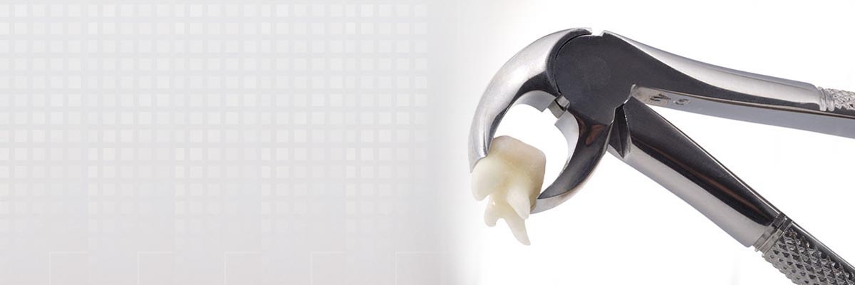 Marietta Tooth Extraction